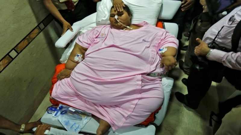 Worlds Heaviest Woman Eman Ahmed Dies In Abu Dhabi 