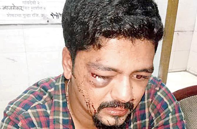 Mumbai Police Arrest Four For Assaulting TV Journalist