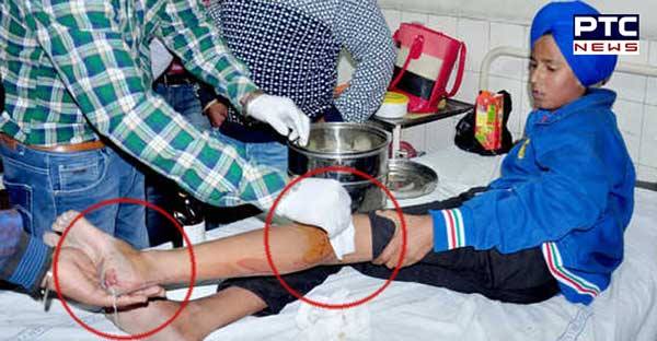 Two students suffer bullet injuries in Amritsar