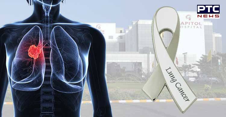 Lung Cancer Awareness Month:  Symptoms, treatment, and prevention of Lung Cancer