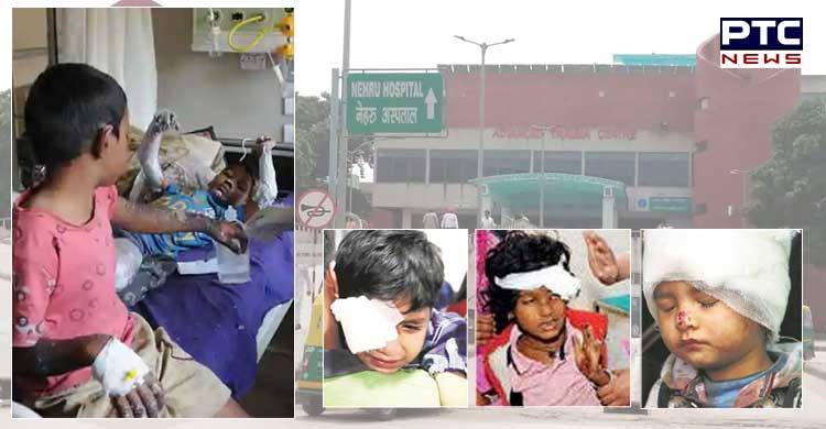 Side effects of firecrackers: injured admitted in PGIMER, Chandigarh