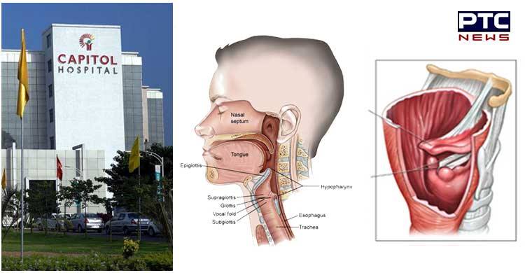 Laryngeal and Hypopharyngeal cancer- symptoms and treatment
