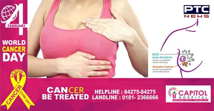 An overview of Breast Cancer- Common signs, symptoms and Risk Factors
