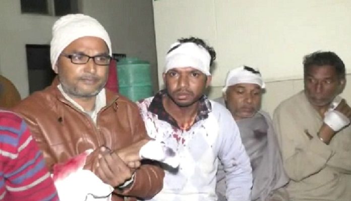 clash 2 grp3 Injured