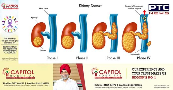 understanding-kidney-cancer-common-types-and-symptoms