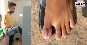 Legendary vote due to lack of hand pictures viral