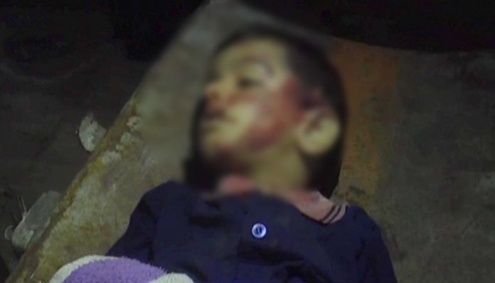 Children Killed 1 Children Killed 1