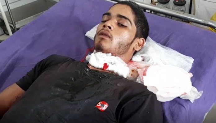 Friend stabbed friend in Palwal of Haryana | Haryana News Friend stabbed friend in Palwal of Haryana | Haryana News