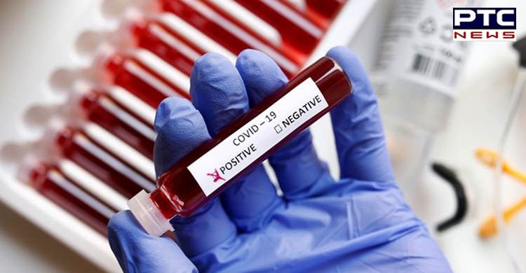 Mohali reports 16 new cases of coronavirus; tally rises to 472