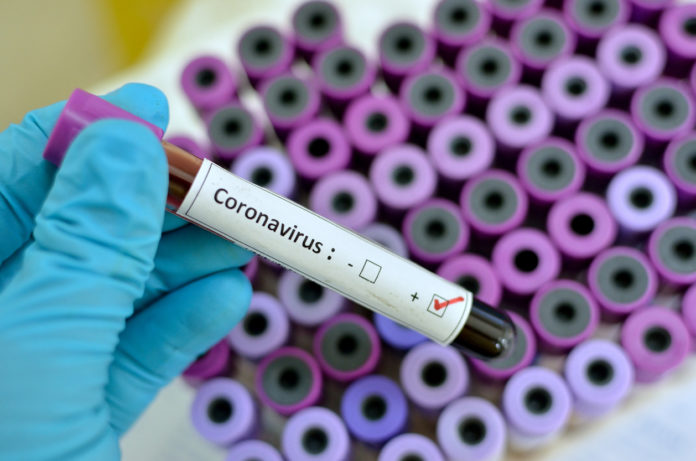 40 new corona infected patients confirmed in Panchkula today 40 new corona infected patients confirmed in Panchkula today