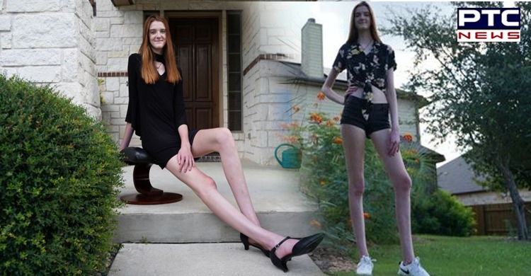 Year Old Breaks Guinness World Record For Longest Legs