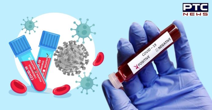 ICMR issues advisory for COVID-19 testing during second wave of coronavirus in India ICMR issues advisory for COVID-19 testing during second wave of coronavirus in India