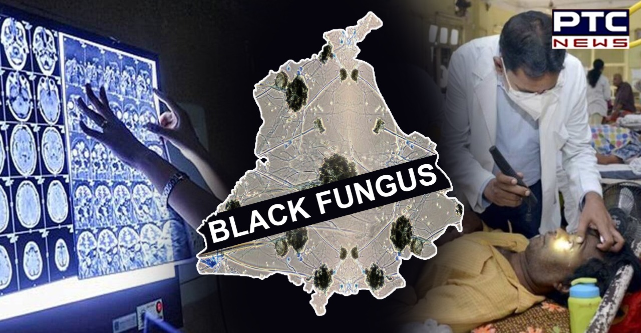 Black Fungus cases in Punjab rise to 188, CM orders ramp-up of alternate drugs