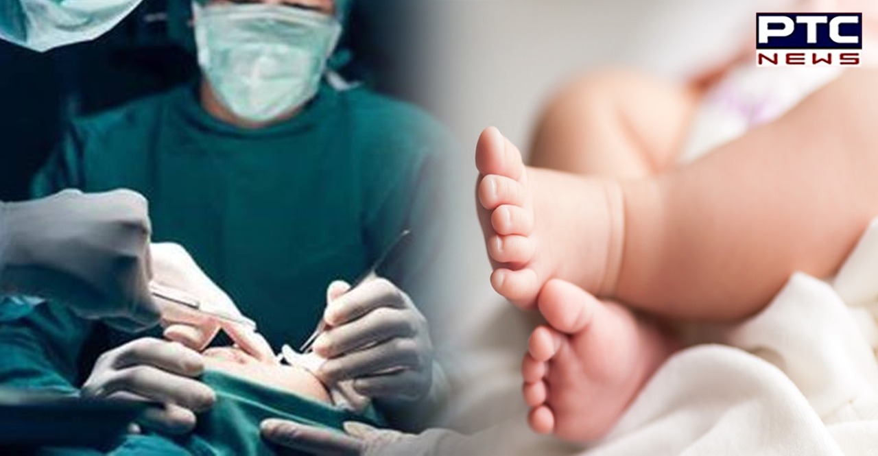 Ludhiana doctors successfully remove one-year-old boy’s third leg in 6-hour-long surgery