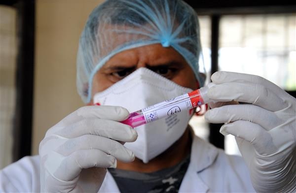 ਪੰਜਾਬ 'ਚ ਕੋਰੋਨਾ ਵਾਇਰਸ ਦੇ ਇੰਨੇ ਨਵੇਂ ਮਾਮਲੇ, 15 ਮਰੀਜ਼ਾਂ ਦੀ ਗਈ ਜਾਨ