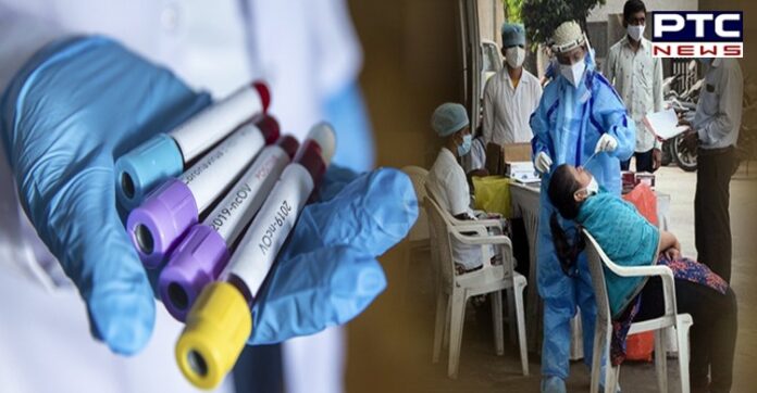 Coronavirus update: India records 18,987 fresh Covid-19 cases, 246 deaths Coronavirus update: India reports 10,549 new Covid-19 cases, 488 deaths