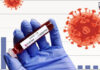 Coronavirus Update: India logs 2,85,914 new Covid-19 cases in last 24 hours