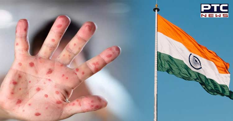 12 ਦੇਸ਼ਾਂ 'ਚ ਫੈਲਿਆ Monkeypox, WHO ਨੇ ਦਿੱਤੀ ਚੇਤਾਵਨੀ, ਕੀ ਭਾਰਤ 'ਚ ਵੀ ਫੈਲੇਗਾ ਇਹ?
