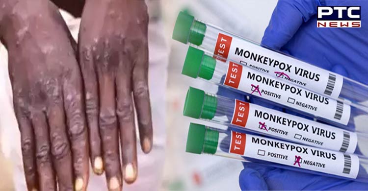 No monkeypox case reported in India; Centre acts proactive, issues  guidelines