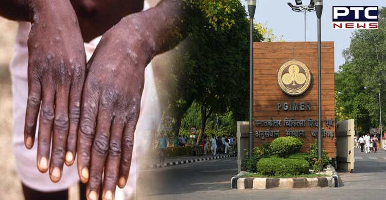 Chandigarh issues advisory amid monkeypox fear