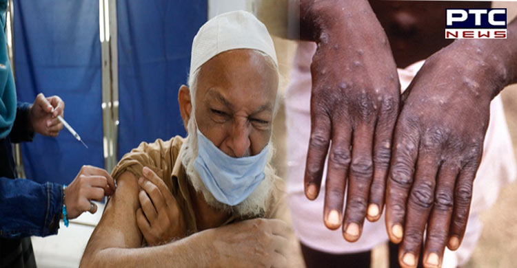 Pakistan: No diagnostic facility to detect Monkeypox