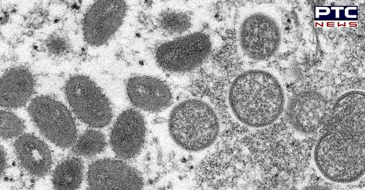 Pakistan-No-diagnostic-facility-to-detect-Monkeypox-5