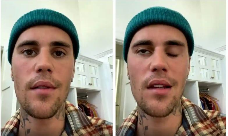 Half of Justin Beiber's face paralysed by serious virus, cancels shows