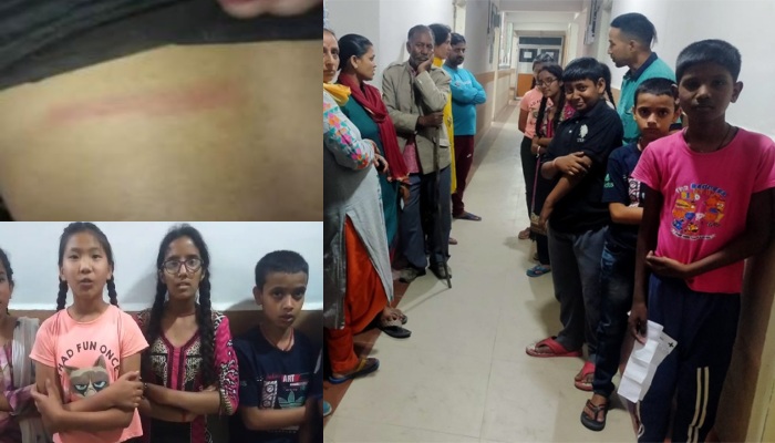 बीएड प्रशिक्षु टीचर ने गुस्से में पीट डाली पूरी क्लास, 22 छात्रों को आई चोटें