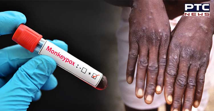 World Health Network declares Monkeypox outbreak a public health emergency