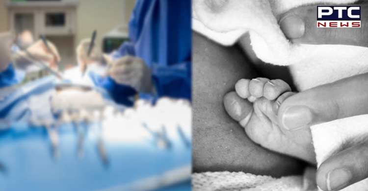 Newborn decapitated, head left inside mom's womb in Pakistan