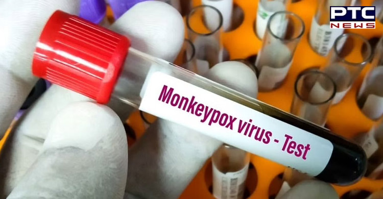 Know how to protect yourself, others against Monkeypox 