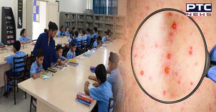 MFHD' disease that is continuously spreading in schools of Chandigarh, pre-primary classes were held online