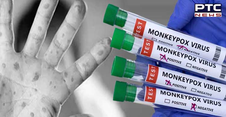 Centre floats tender to develop monkeypox vaccine, diagnostic kits