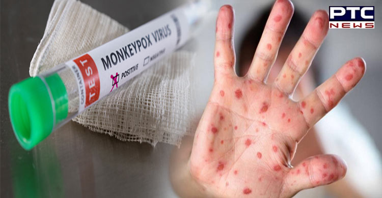 Monkeypox cases exceed 14,000; WHO reconvenes emergency committee meeting - PTC  News