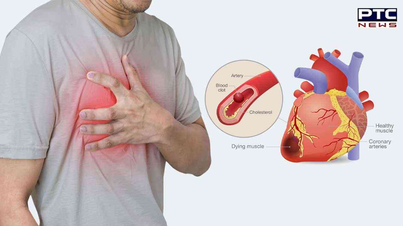 Early births, onset of periods may increase risk of cardiovascular disease