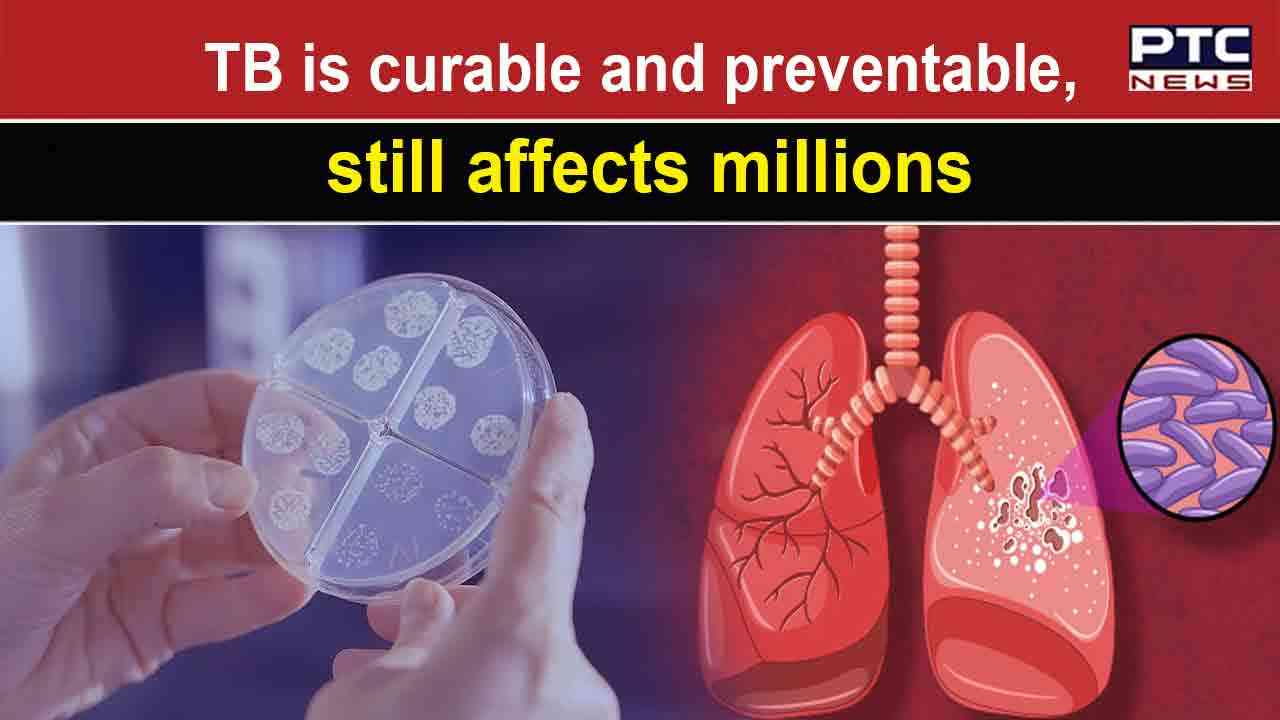 World TB Day 2023 How To Eradicate TB Worldwide News Ticker PTC News   Tbvirus1 1ad19d1f3ab6f1fa8bb7e2dce41f6fb7 1280X720.webp