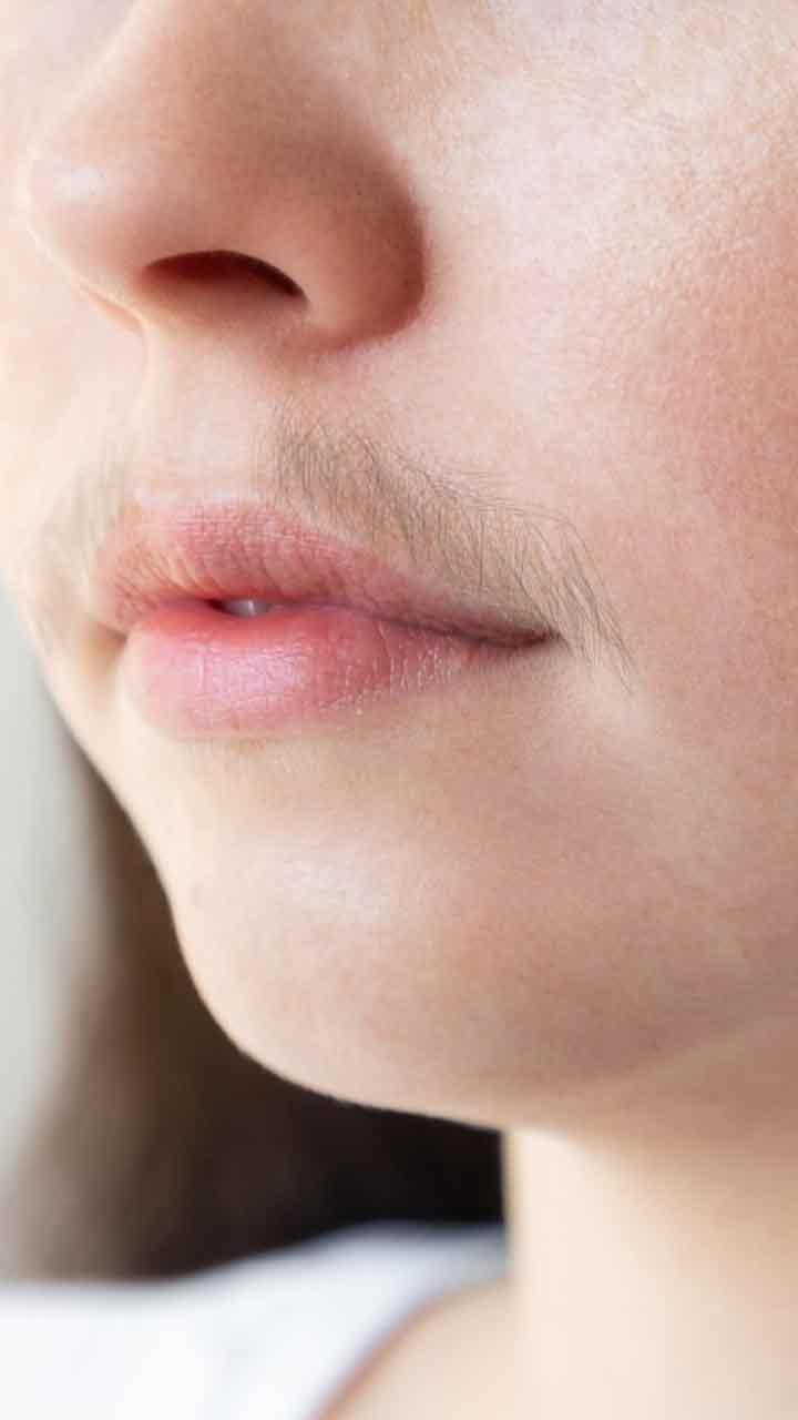 ਚਿਹਰੇ ਤੋਂ ਅਣਚਾਹੇ ਵਾਲਾਂ ਨੂੰ ਹਟਾਉਣ ਦੇ ਨੁਕਤੇ